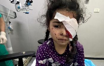 وزارة الصحة بغزة تفتح باب التسجيل للمتضررين من فقدان البصر جراء الحرب