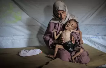 كارثة إنسانية في غزة: وفيات بين الأطفال بسبب سوء التغذية وغياب حليب الرضع