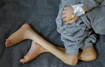 8 حالات وفاة نتيجة المجاعة وسوء التّغذية خلال الـ 24 ساعة الماضية