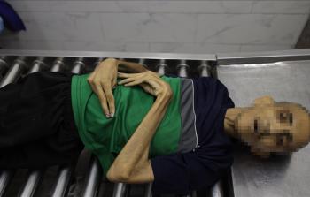 حمادة ورش الأغا... شابّ في مقتبل العمر يموت جوعًا في غزَّة