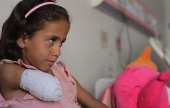 الأورومتوسطي: أكثر من 30 فلسطينيًا يوميًا يُصابون بالإعاقة في غزة