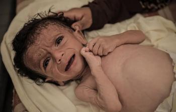 وزارة الصحة بغزَّة: تسجيل 7 حالات وفاة جديدة خلال 24 ساعة فقط