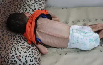 وزير خارجية النرويج: غزَّة تعاني من مجاعة متكررة وكارثة هائلة