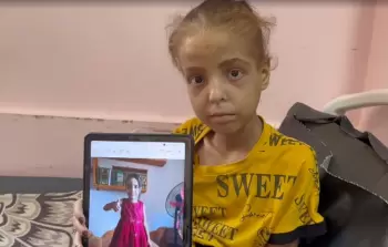 مستشفى الشِّفاء بغزَّة يحذِّر من أزمة غذائيَّة تهدِّد حياة المرضى