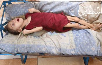 بعد نشر قصتها في 