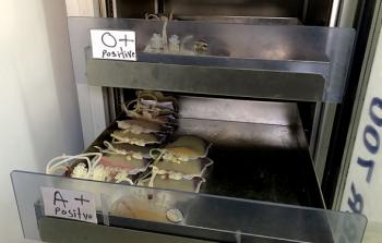 البرش: من بين كل 10 أشخاص لا يوجد سوى اثنين قادرين على التبرع بالدم في غزَّة