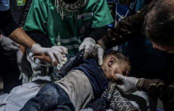 83% نسبة المدنيين بين الشهداء.. الإبادة الجماعية أمام حقائق دامغة