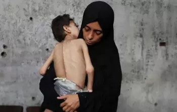 ارتفاع عدد ضحايا المجاعة وسوء التَّغذية في غزَّة إلى 266 شهيدًا منذ بدء الإبادة