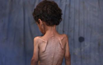 المجاعة بغزَّة تتعمَّق... فصائل العمل الوطنيِّ والإسلاميِّ تطالب بتحرُّك دوليّ عاجل