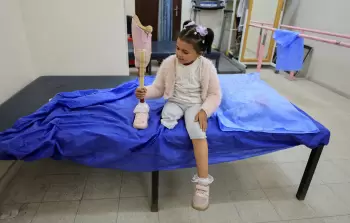 مدير مستشفى حمد: أكثر من 6500 حالة بتر في غزة والحصار يعرقل تصنيع الأطراف الصناعية