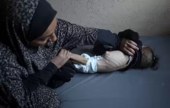 8 حالات وفاة نتيجة المجاعة في غزَّة خلال الـ 24 ساعة الماضية