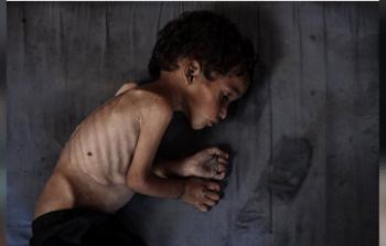 صحيفةٌ بريطانية: الأمم المتحدة ستعلن المجاعة في مدينة غزة