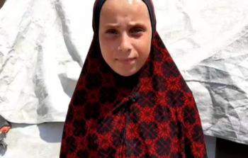 الطفلة أنسام زيد.. صراع مع مرض السرطان والحرب