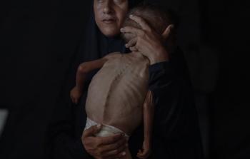 طفل من كلِّ ثلاثة لم يتناول طعامًا خلال 24 ساعة في غزّة