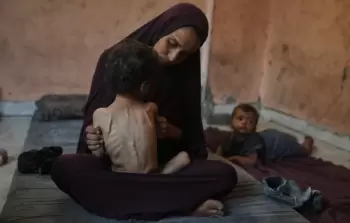 5 حالات وفاة نتيجة المجاعة وسوء التَّغذية في غزَّة