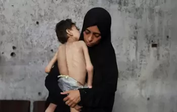 الصِّحَّة: ارتفاع إجمالي وفيات سوء التغذية والمجاعة إلى 370 شهيدًا