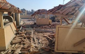 الصحة تُدين استهداف الاحتلال مستشفى الرنتيسي.. 