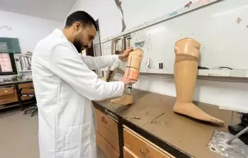 وزارة الصحة: النساء يشكلن نحو 8% من بين حالات البتر الموثقة