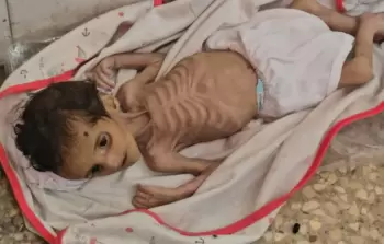 الأونروا: وفيات الجوع في غزَّة أكبر بكثير من الأرقام الرَّسميَّة