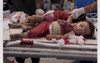 لليوم الـ 722.. الاحتلال يُواصل مجازره الدَّامية في قطاع غزة