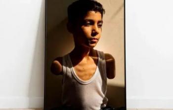 الأمم المتحدة: 21 ألف طفل في غزَّة أصيبوا بإعاقات منذ بدء الحرب