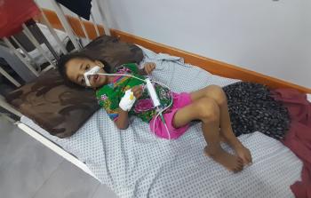 وجه شاحب وعظام بارزة... لمياء 