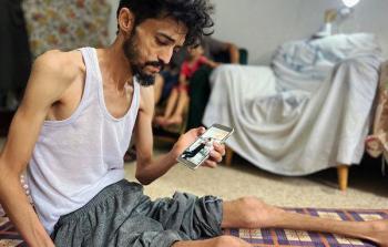 المجاعة والإصابة والمرض... ثالوث الإبادة يجتمع على جسد الشَّابِّ 