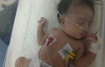 ألمي... رضيعة تصارع الموت على جهاز الأكسجين