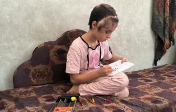 الطفلة مريم إبراهيم تهشمت جمجمتها بفعل شظايا صاروخ أطلقته طائرة مسيرة (تصوير: خاص)