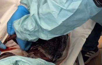 جثمان شهيد تعرض للتعذيب الشديد من قبل الاحتلال