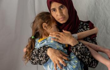 الصحة بغزة: حالتا وفاة بالمجاعة وسوء التغذية خلال الـ 24 ساعة الماضية