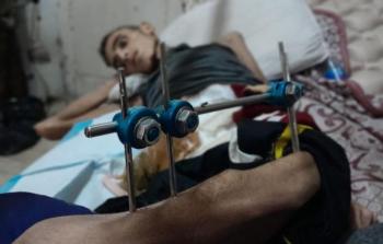 16,500 مريض في غزة ما زالوا ينتظرون إجلاءهم للعلاج في الخارج