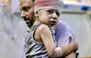 طفل أصيب في غارة 