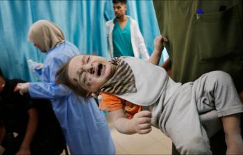 طفل أصيب في غارة 