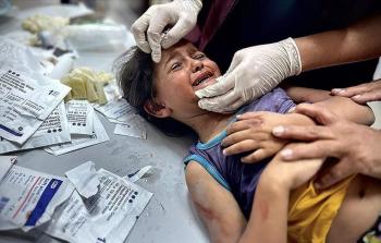 طفلة مصابة بنيران الاحتلال في غزة