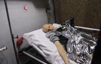 الأسير المحرر إبراهيم عبد المنعم فقد بصره بشكل كامل جراء التعذيب والانتهاكات المتواصلة التي تعرض لها في سجون الاحتلال