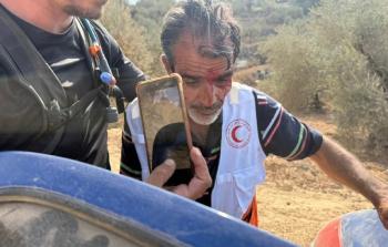 إصابة مسعف خلال هجوم المستوطنين جنوبي نابلس