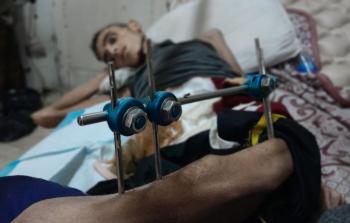 جريح الحرب رفيق دغمش بين الحياة والموت على أسرَّة العلاج في المستشفى الأهلي العربي 