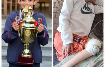 الطفل مهند التلمس