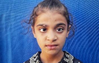 نعيمة أصيبت بجراح بالغة في الوجه وتواجه خطر فقدان النظر بعينها اليمني