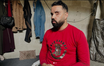 الشاب الفلسطيني أسامة الجماصي فقد بصره بالكامل منذ الأيام الأولى للحرب بعد أن اخترقت شظايا القصف عينيه