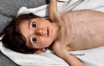 الطفل زين الهندي (4 أعوام)