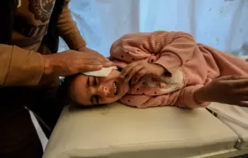 صورة أرشفية لطفلة أصيبت بقصف الاحتلال على غزة
