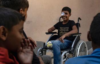 طفل من غزة مبتور القدم جراء قصف الاحتلال خلال حرب الإبادة الجماعية