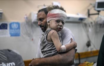 طفل أصيب في غارة 