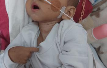 الطفلة  لميس إبراهيم أبو مصطفى