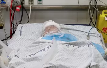 صورة أرشيفية لطفلة مصابة جراء قصف الاحتلال على غزة