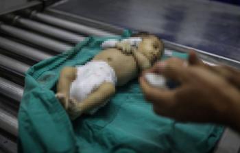 يعيش عشرات الآلاف من المواطنين داخل خيام تفتقر لأدنى مقومات الحماية من الصقيع