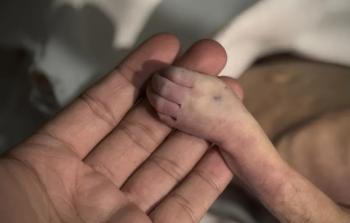 رفض الاحتلال إدخال مواد الإيواء يعرض الأطفال وكبار السن لمخاطر صحية جسيمة