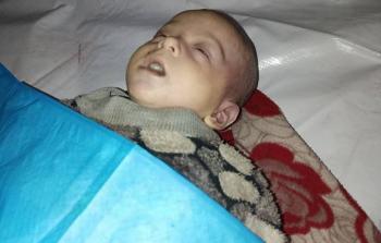 الرضيعة شذا أبو جراد البالغة من العمر 7 أشهر توفيت في مدينة غزة؛ بسبب البرد القارس